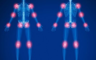 River News: Tony Teramana Cancer Center introduces innovative osteoarthritis radiation therapy to the Ohio Valley